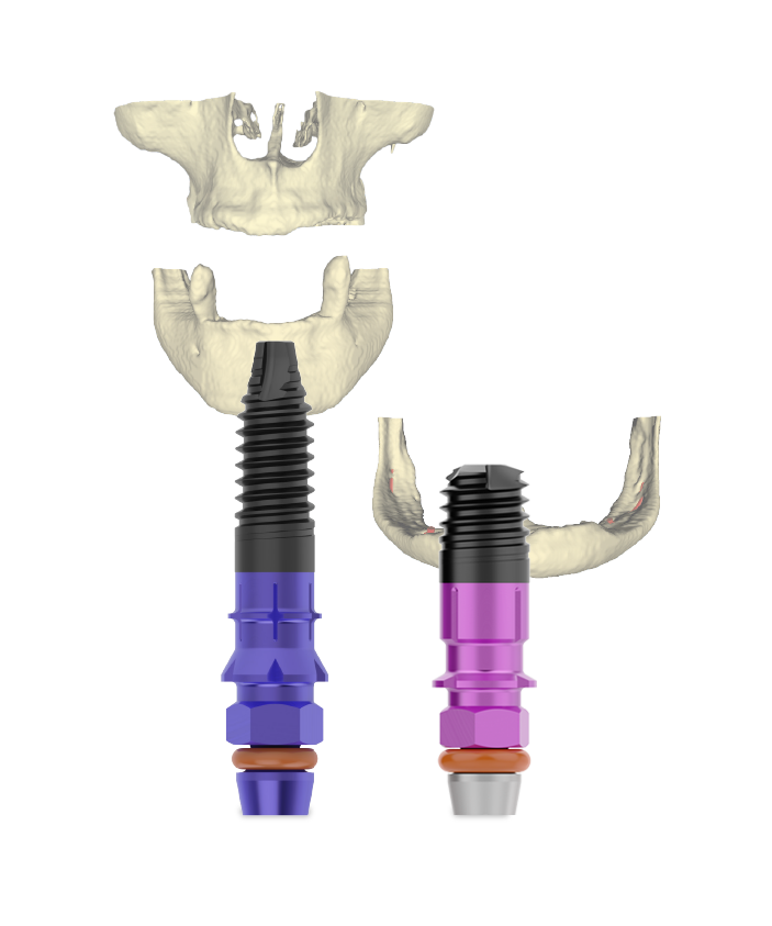 Solutions for bone atrophies