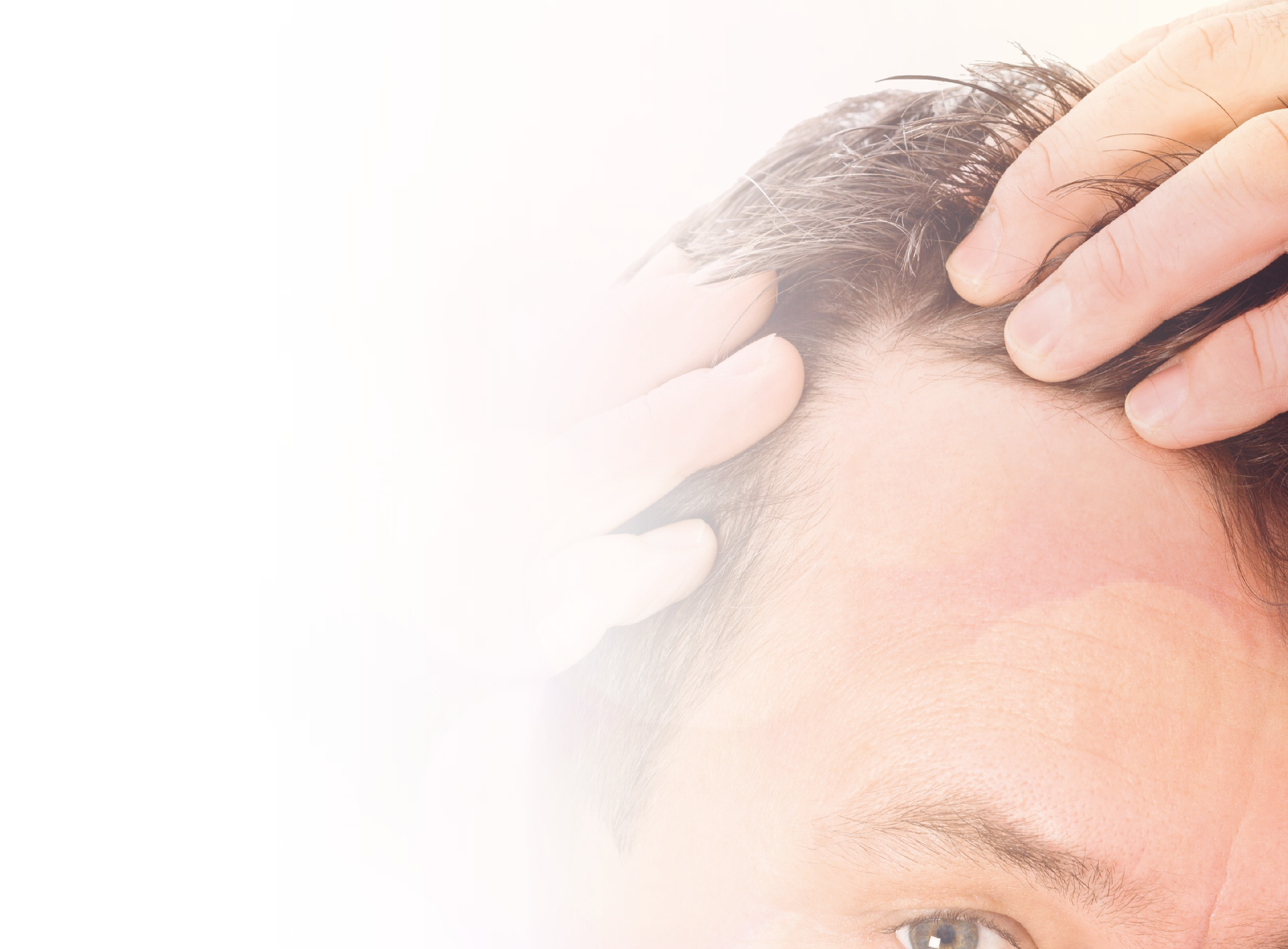 Management of androgenetic alopecia: a comparative clinical study between plasma rich in growth factors and topical minoxidil