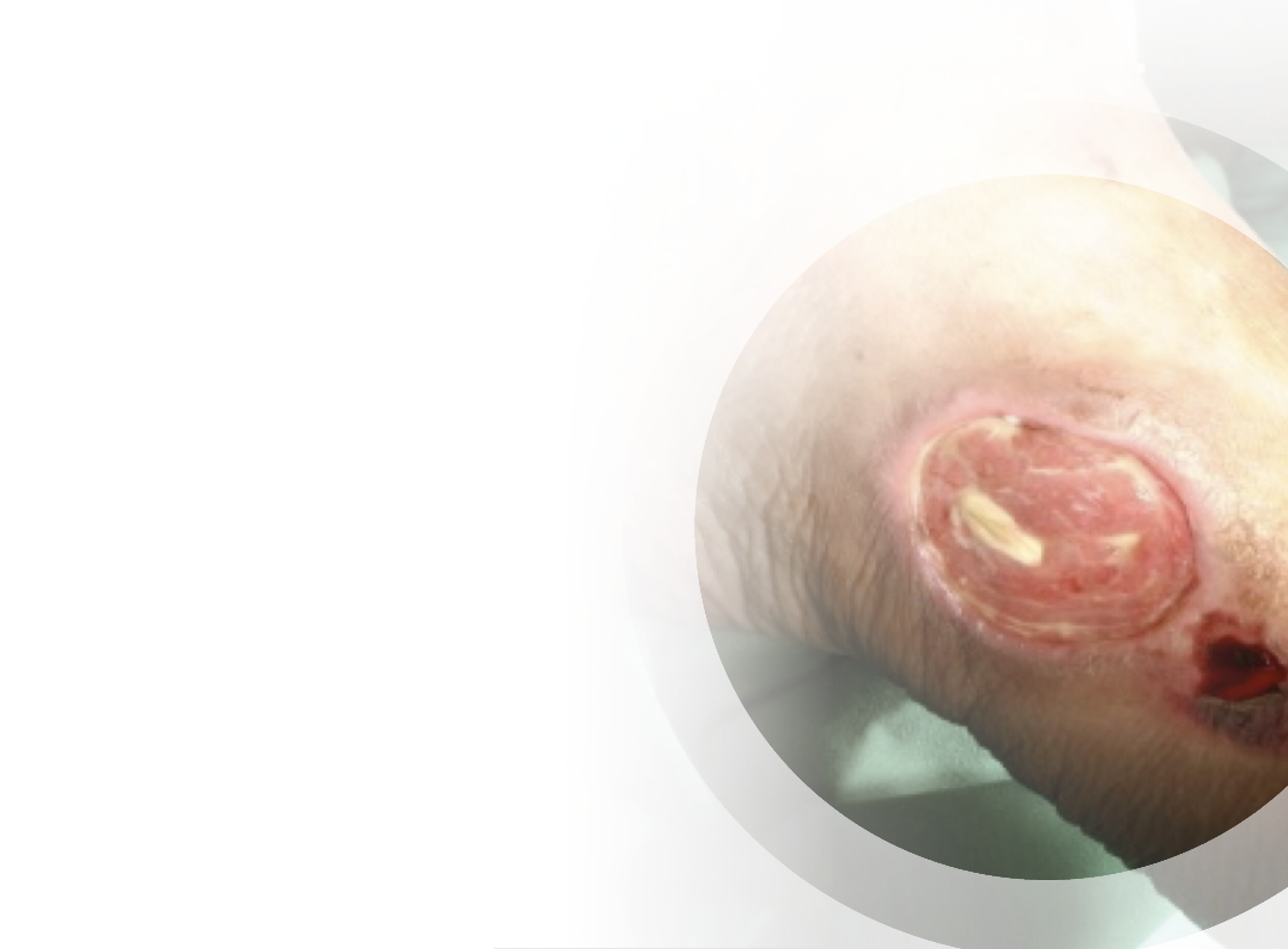 In vitro and in vivo Effect of Platelet-Rich Plasma-Based Autologous Topical Serum on Cutaneous Wound Healing