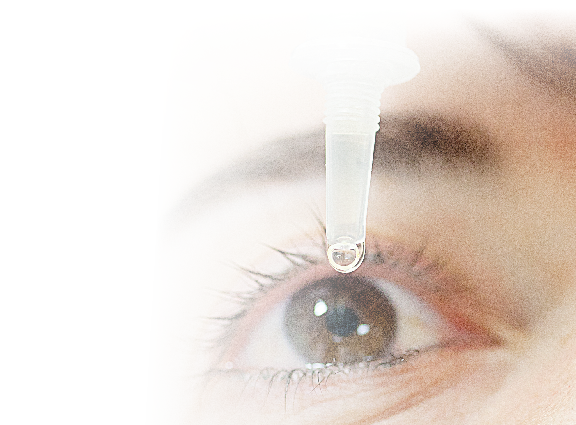 Plasma Rich in Growth Factors as a Therapeutic Agent for Persistent Corneal Epithelial Defects