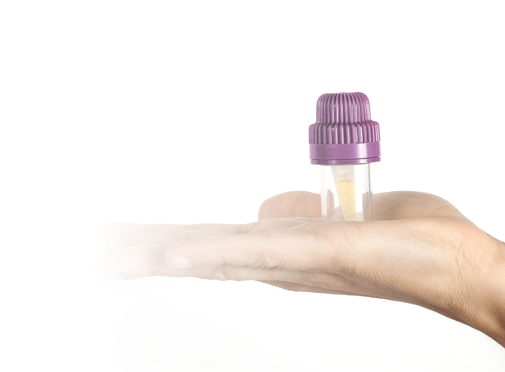 Short- and Long-Term Stability of Plasma Rich in Growth Factors Eye Drops